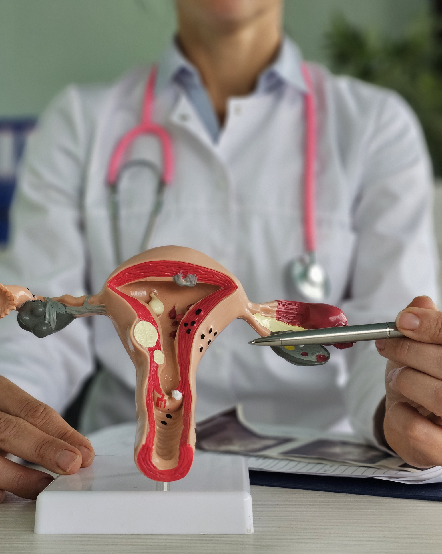 Woman gynecologist holding anatomical model of uterus and ovaries. Healthy female reproductive system, medicine, conception