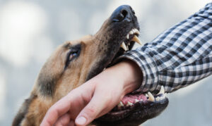 Phoenix, AZ dog bite lawyer