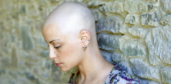 taxotere-alopecia-patient