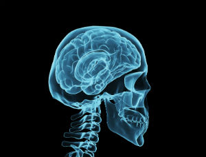 brain injury scan